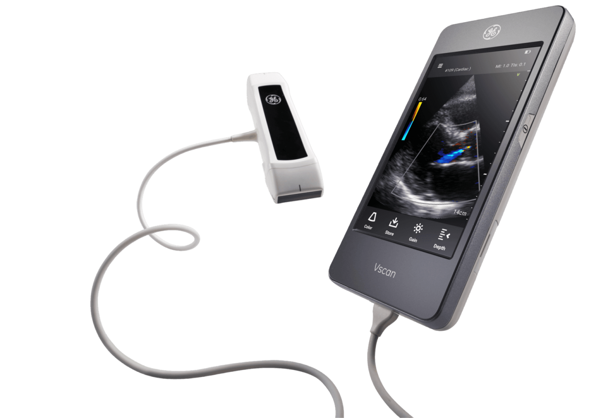 Echographe ultraportable GE Healthcare Nos produits